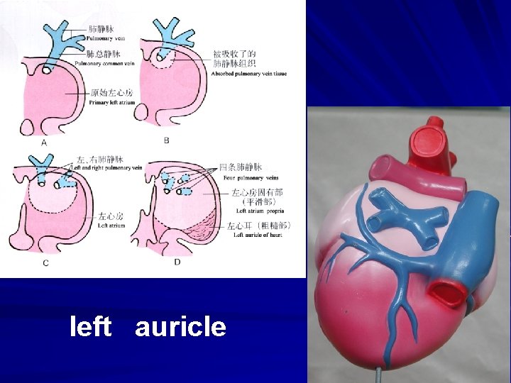left auricle 