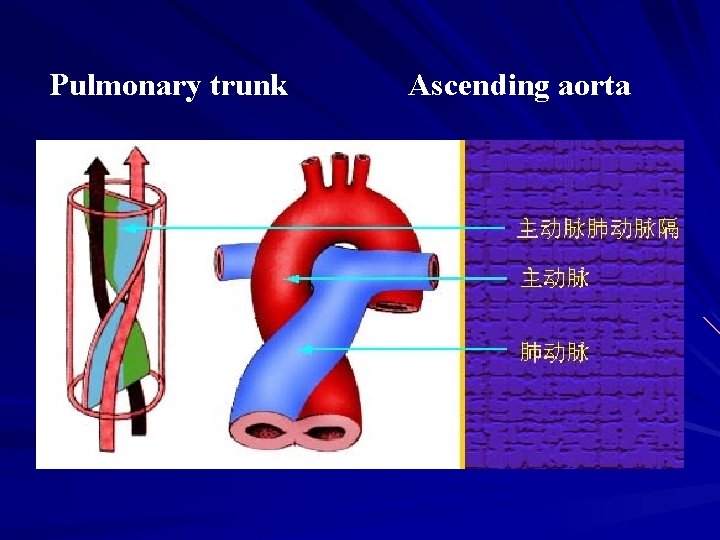 Pulmonary trunk Ascending aorta 