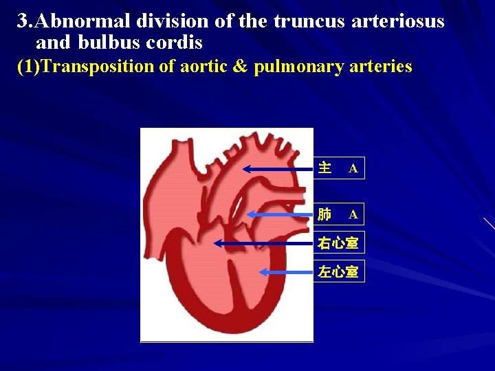 3. Abnormal division of the truncus arteriosus and bulbus cordis (1)Transposition of aortic &