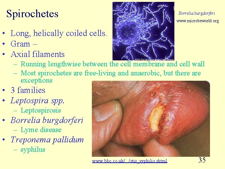 Spirochetes Borrelia burgdorferi www. microbeworld. org • Long, helically coiled cells. • Gram –