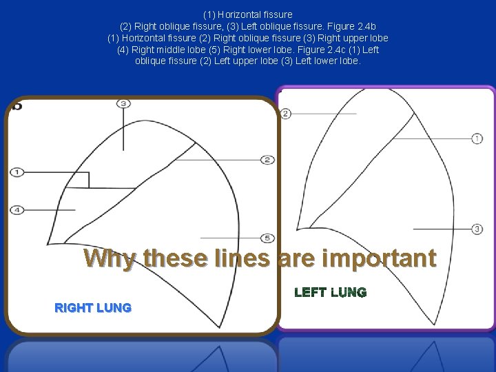 (1) Horizontal fissure (2) Right oblique fissure, (3) Left oblique fissure. Figure 2. 4