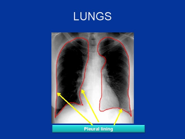 LUNGS Pleural lining 