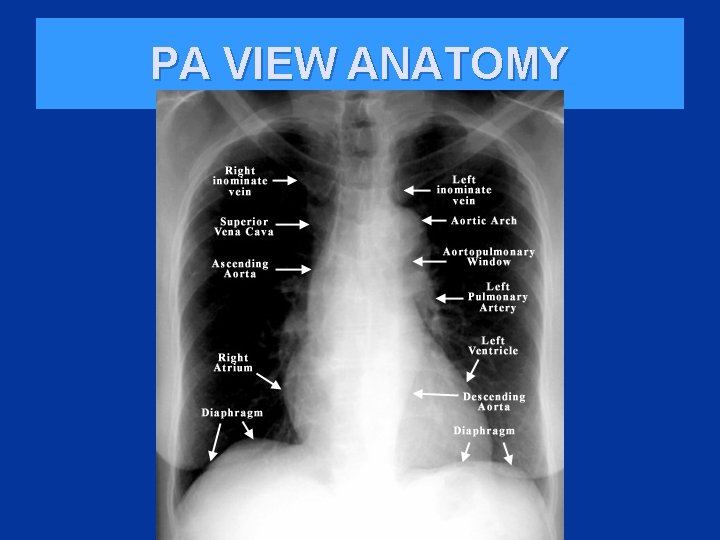 PA VIEW ANATOMY 