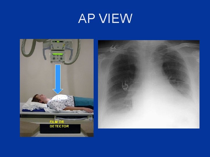 AP VIEW 