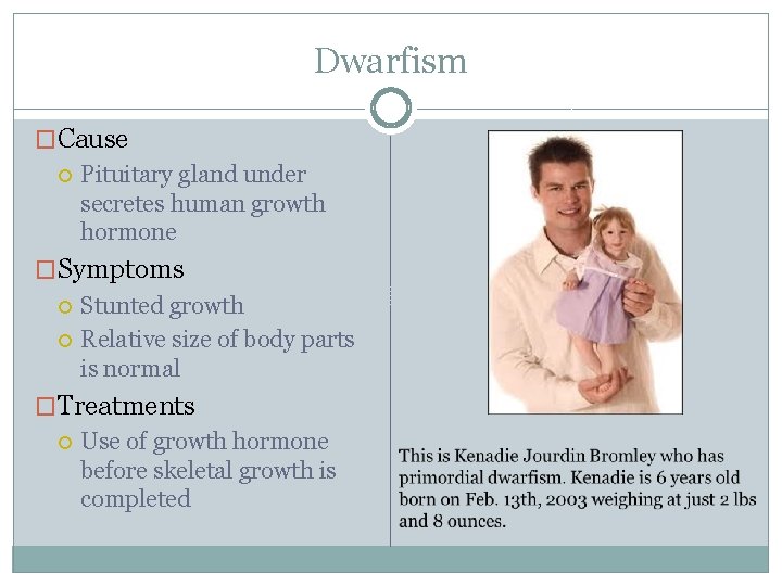 Dwarfism �Cause Pituitary gland under secretes human growth hormone �Symptoms Stunted growth Relative size