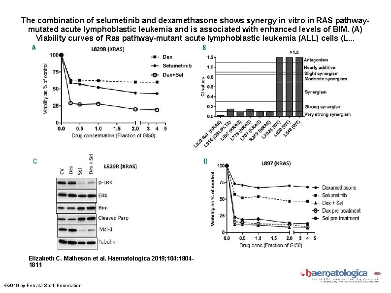 The combination of selumetinib and dexamethasone shows synergy in vitro in RAS pathwaymutated acute