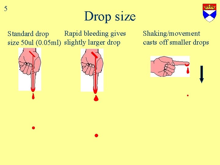 5 Drop size Rapid bleeding gives Standard drop size 50 ul (0. 05 ml)