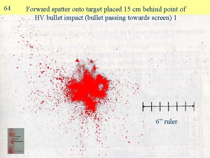 64 Forward spatter onto target placed 15 cm behind point of HV bullet impact