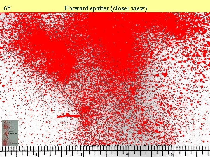 65 Forward spatter (closer view) 