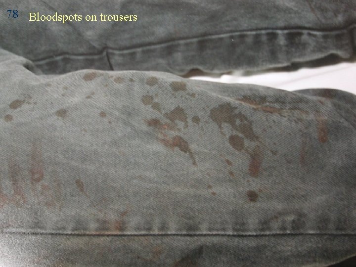 78 Bloodspots on trousers 