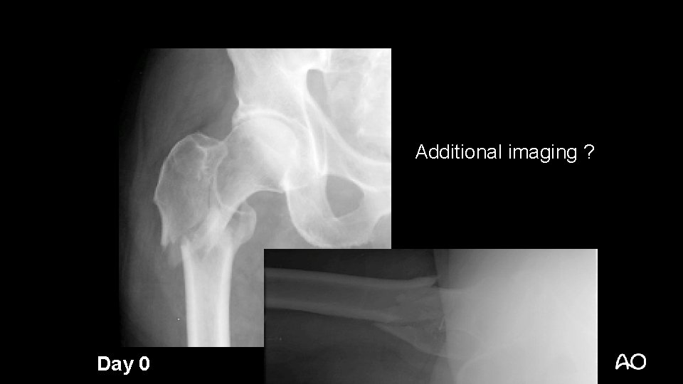 Additional imaging ? Day 0 