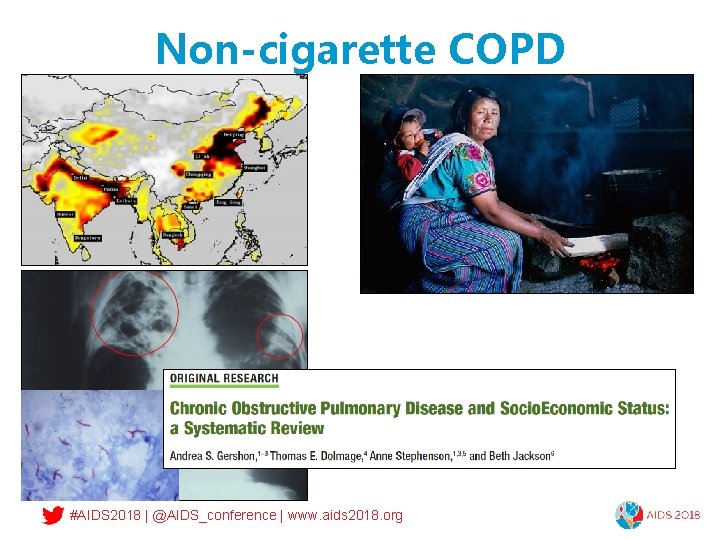 Non-cigarette COPD #AIDS 2018 | @AIDS_conference | www. aids 2018. org 