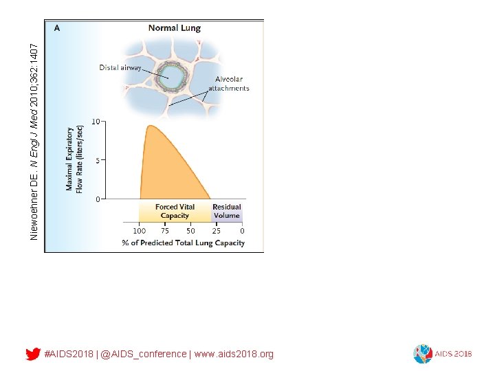 Niewoehner DE. N Engl J Med 2010; 362: 1407 What is COPD? • Collapsible