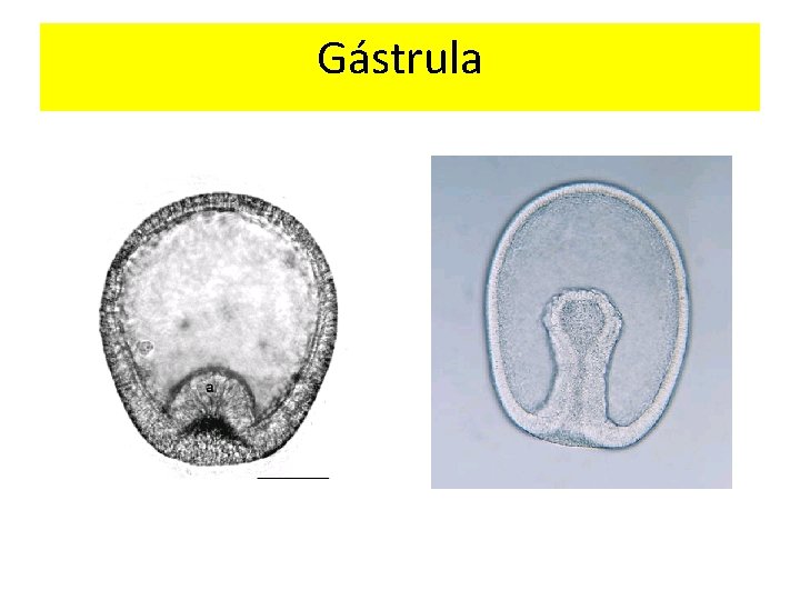 Gástrula 