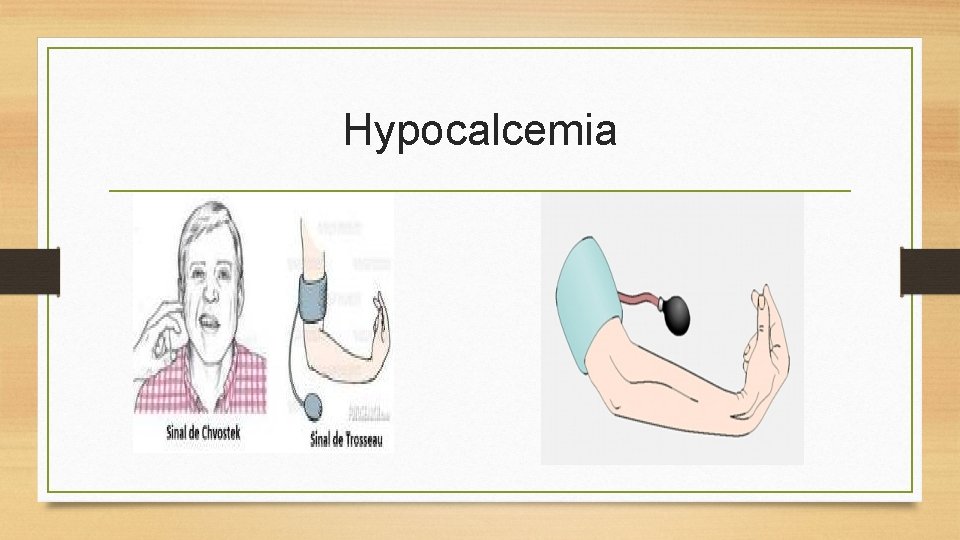 Hypocalcemia 