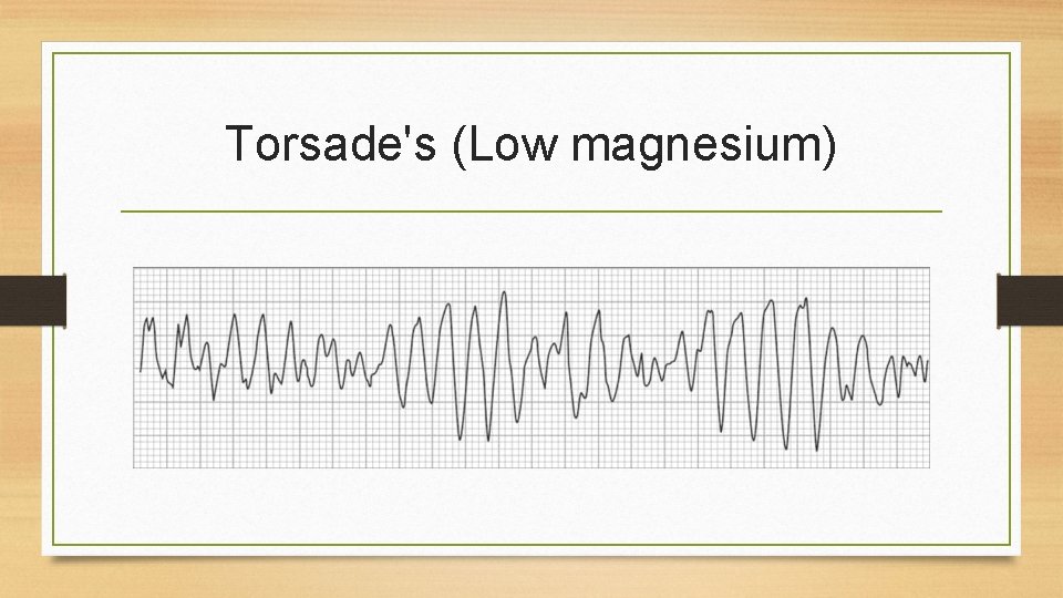 Torsade's (Low magnesium) 