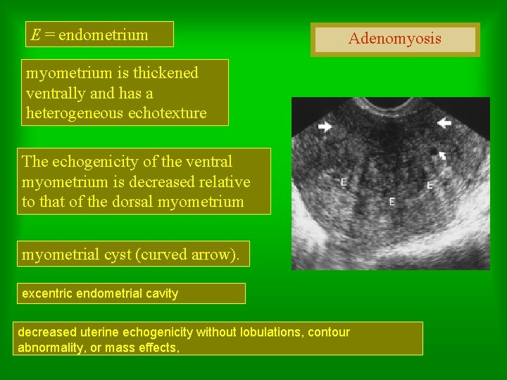 E = endometrium Adenomyosis myometrium is thickened ventrally and has a heterogeneous echotexture The