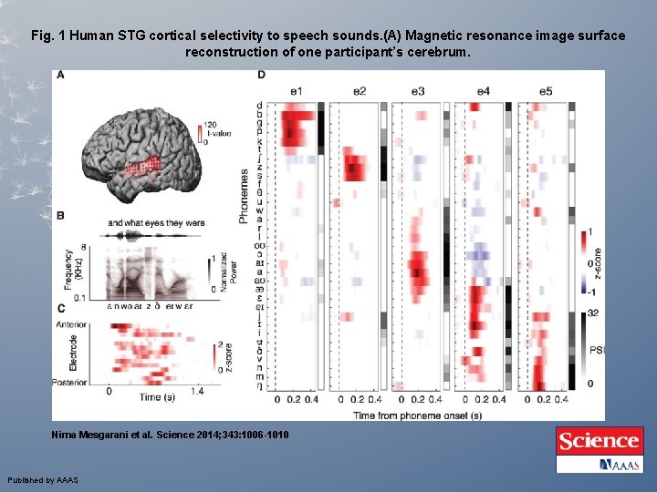 Fig. 1 Human STG cortical selectivity to speech sounds. (A) Magnetic resonance image surface Fig. 1 Human STG cortical selectivity to speech sounds. (A) Magnetic resonance image surface