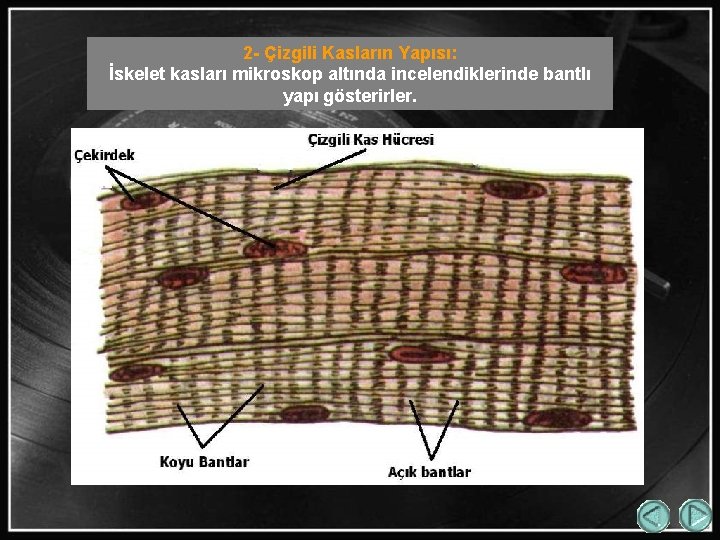 2 - Çizgili Kasların Yapısı: İskelet kasları mikroskop altında incelendiklerinde bantlı yapı gösterirler. 