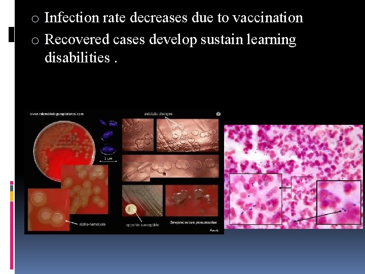 o Infection rate decreases due to vaccination o Recovered cases develop sustain learning disabilities.
