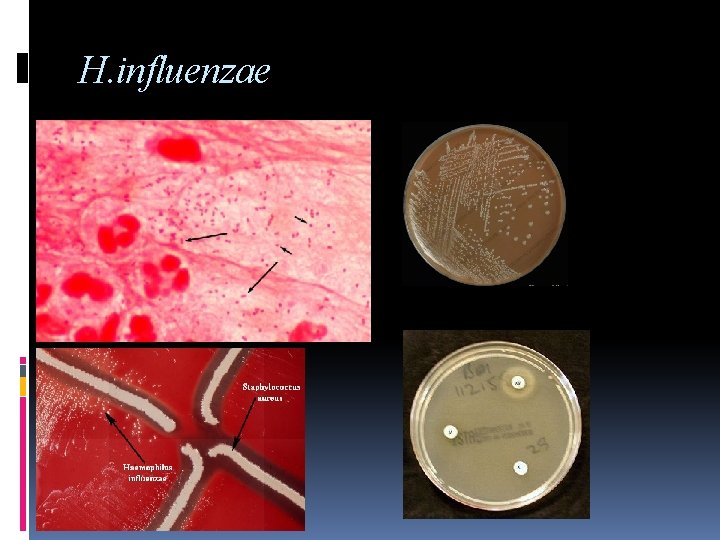 H. influenzae 