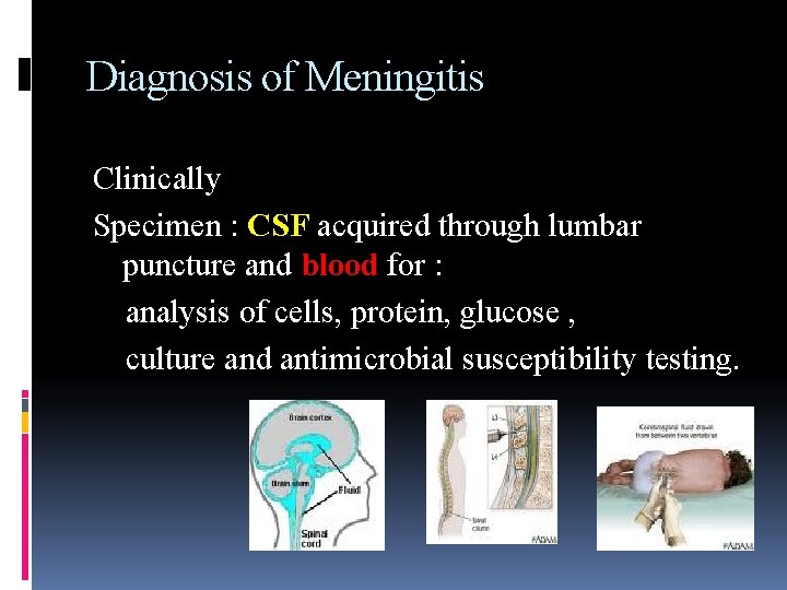 Diagnosis of Meningitis Clinically Specimen : CSF acquired through lumbar puncture and blood for