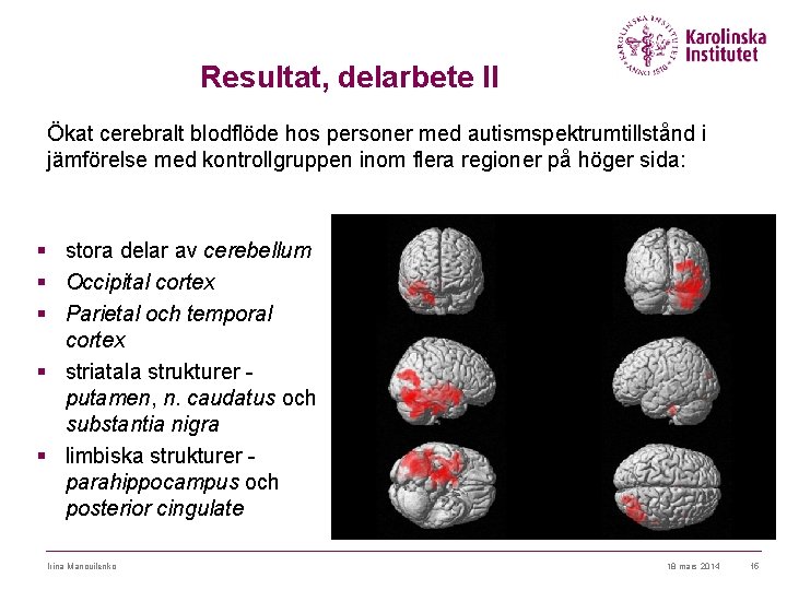 Resultat, delarbete II Ökat cerebralt blodflöde hos personer med autismspektrumtillstånd i jämförelse med kontrollgruppen