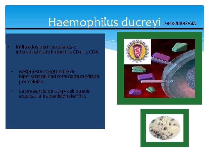 Haemophilus ducreyi Bacteria cocobacilar gramnegativa de crecimiento exigente. e • Infiltrados peri vasculares intersticiales