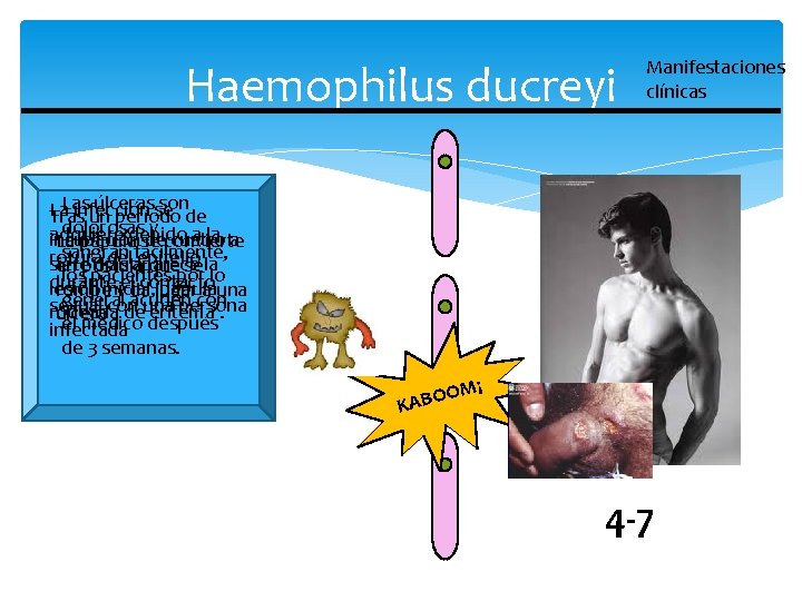 Haemophilus ducreyi Manifestaciones clínicas Las úlcerasse son La infección Tras un período de dolorosas