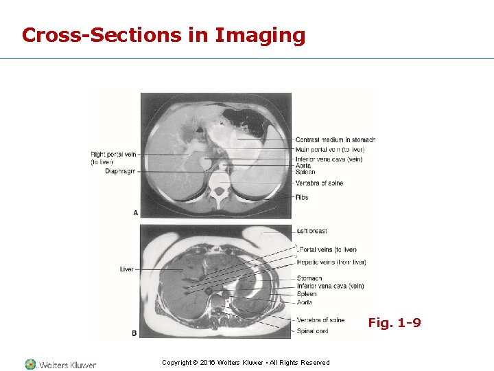 Cross-Sections in Imaging Fig. 1 -9 Copyright © 2016 Wolters Kluwer • All Rights