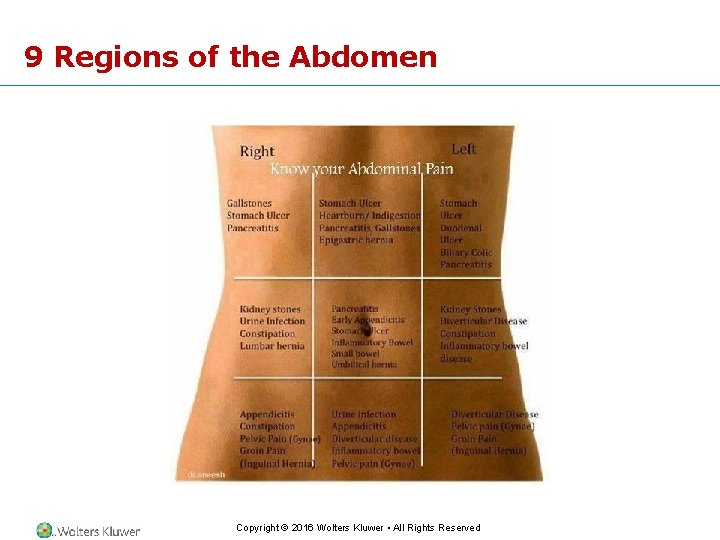 9 Regions of the Abdomen Copyright © 2016 Wolters Kluwer • All Rights Reserved