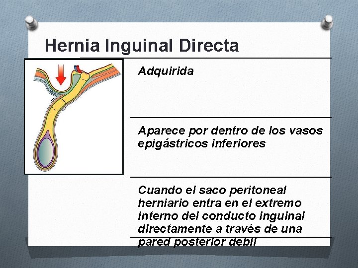 Hernia Inguinal Directa Adquirida Aparece por dentro de los vasos epigástricos inferiores Cuando el