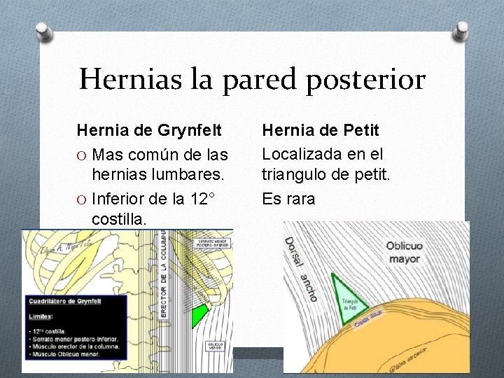 Hernias la pared posterior Hernia de Grynfelt O Mas común de las hernias lumbares.