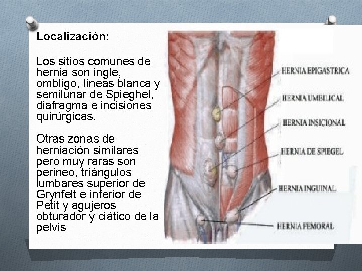 Localización: Los sitios comunes de hernia son ingle, ombligo, líneas blanca y semilunar de