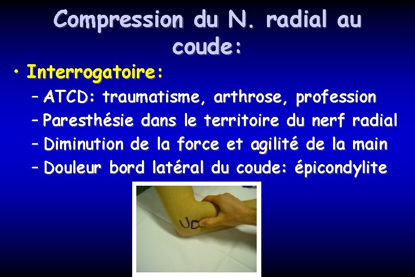 Compression du N. radial au coude: • Interrogatoire: – ATCD: traumatisme, arthrose, profession –