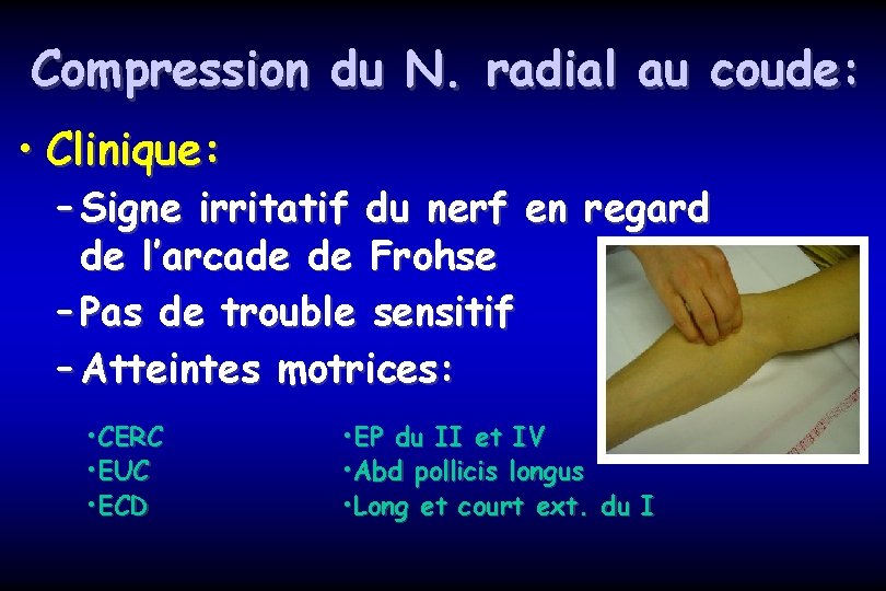 Compression du N. radial au coude: • Clinique: – Signe irritatif du nerf en