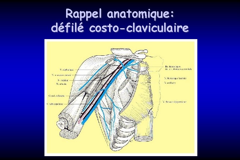 Rappel anatomique: défilé costo-claviculaire 