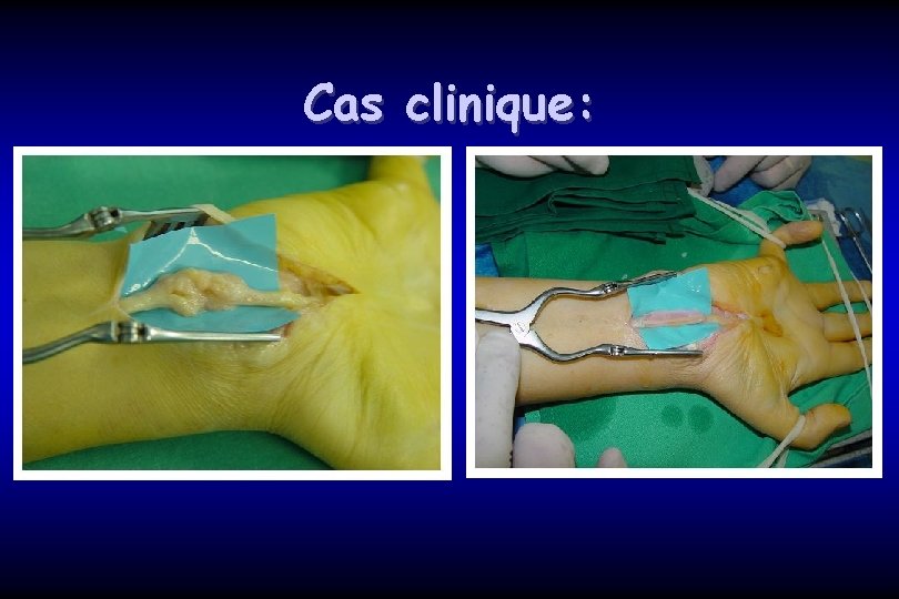 Cas clinique: 