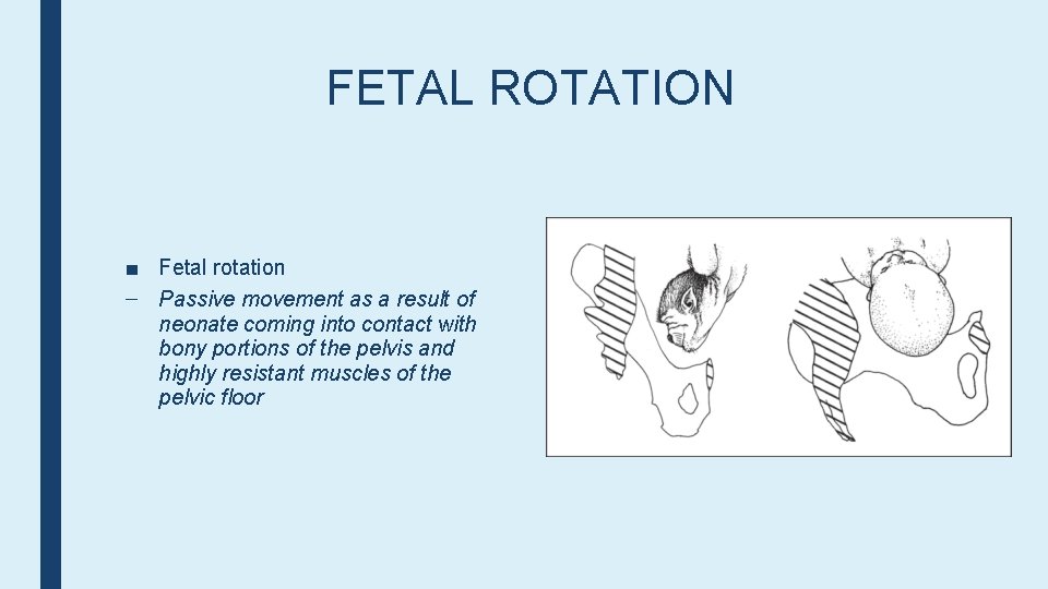 FETAL ROTATION ■ Fetal rotation – Passive movement as a result of neonate coming