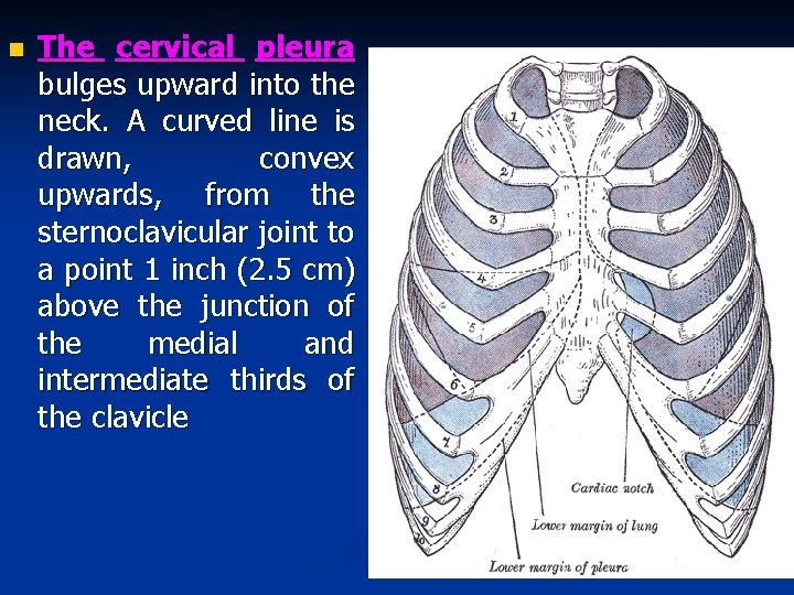 n The cervical pleura bulges upward into the neck. A curved line is drawn,