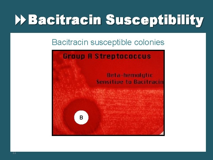  Bacitracin Susceptibility Bacitracin susceptible colonies B 11 