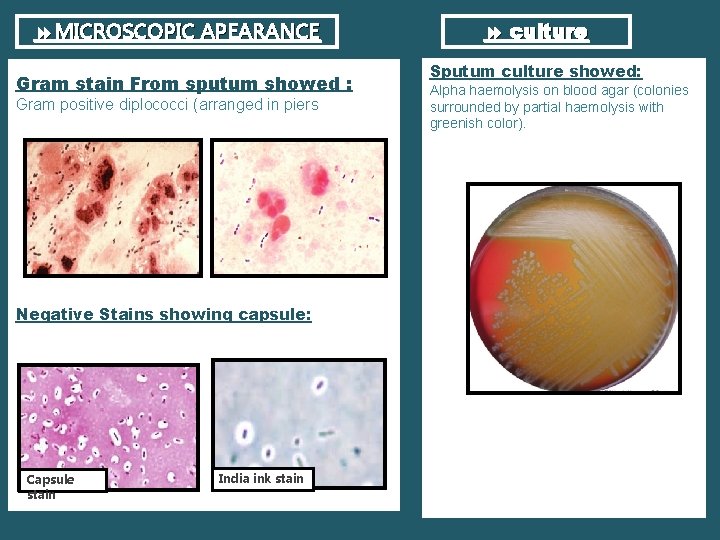  MICROSCOPIC APEARANCE Gram stain From sputum showed : Gram positive diplococci (arranged in