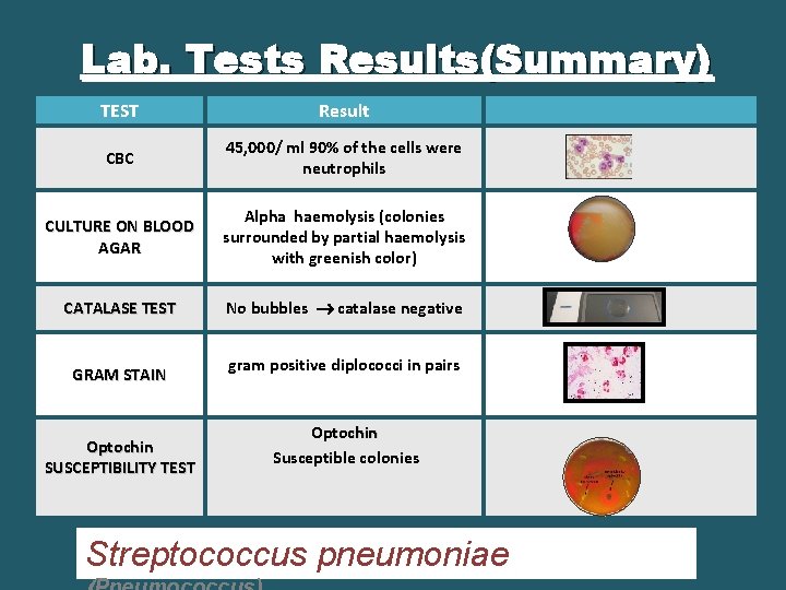 Lab. Tests Results(Summary) TEST Result CBC 45, 000/ ml 90% of the cells were