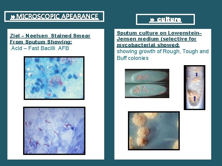  MICROSCOPIC APEARANCE Ziel – Neelsen Stained Smear From Sputum Showing: Acid – Fast