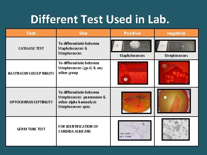 Different Test Used in Lab. Test CATALASE TEST BACITRACIN SUSCEPTIBILITY OPTOCHINSUSCEPTIBILITY GERM TUBE TEST