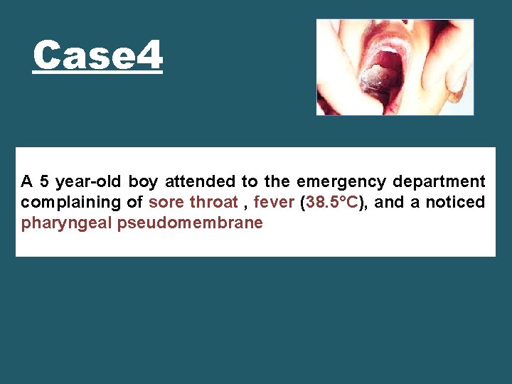 Case 4 A 5 year-old boy attended to the emergency department complaining of sore