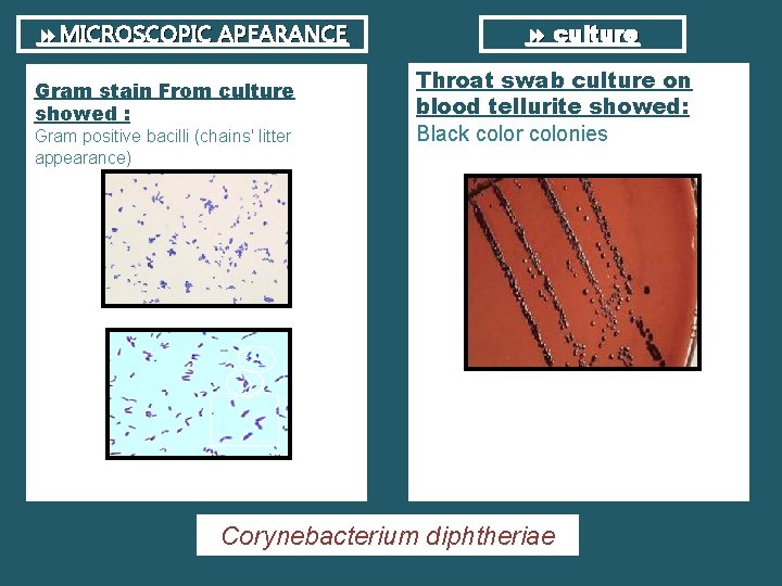  MICROSCOPIC APEARANCE Gram stain From culture showed : Gram positive bacilli (chains' litter