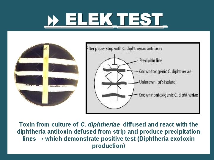  ELEK TEST Toxin from culture of C. diphtheriae diffused and react with the