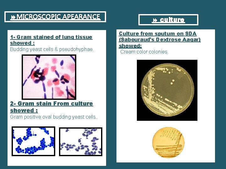  MICROSCOPIC APEARANCE 1 - Gram stained of lung tissue showed : Budding yeast