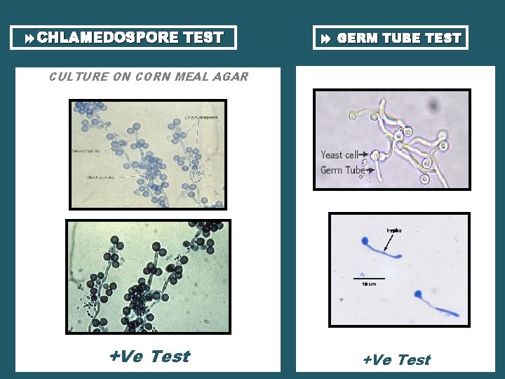  CHLAMEDOSPORE TEST GERM TUBE TEST CULTURE ON CORN MEAL AGAR +Ve Test 